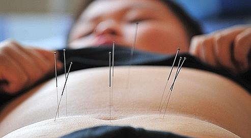 acupunctureFigaro